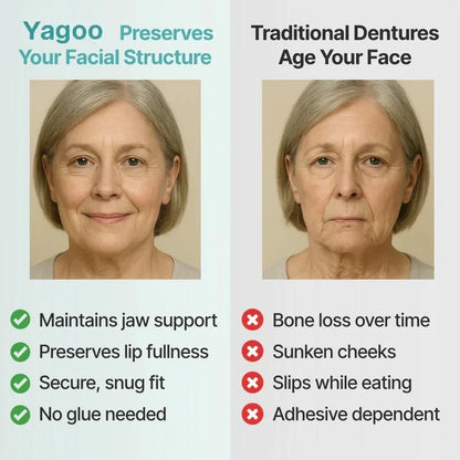 🌎Ends Today: 70% OFF! ⏰Yagoo™ Medical Full Denture with Strong Suction